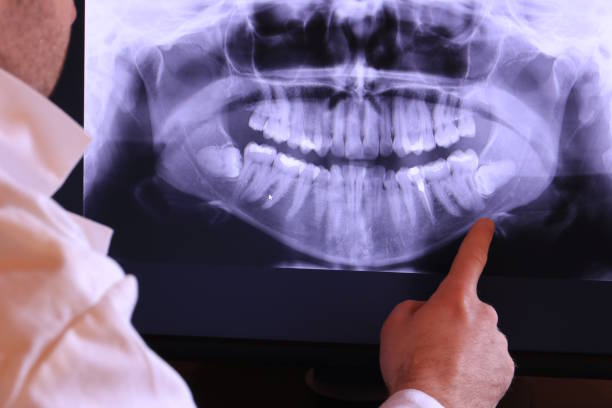 Best Emergency Treatment for Dental Infections or Abscesses in Goshen, AR
